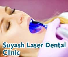 Slider image (1) Suyash Dental Centre